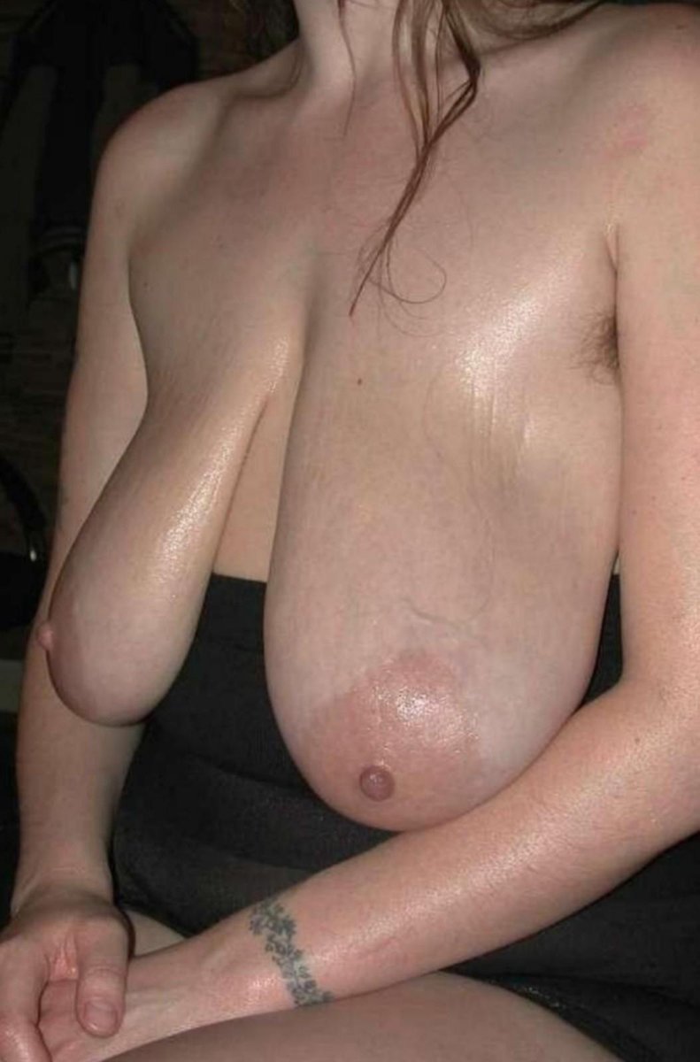 Висячие сиськи с растяжками