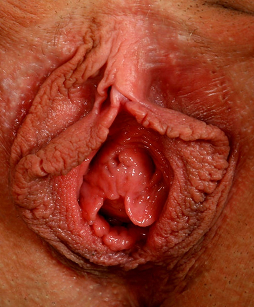 Необычные вагины крупным планом