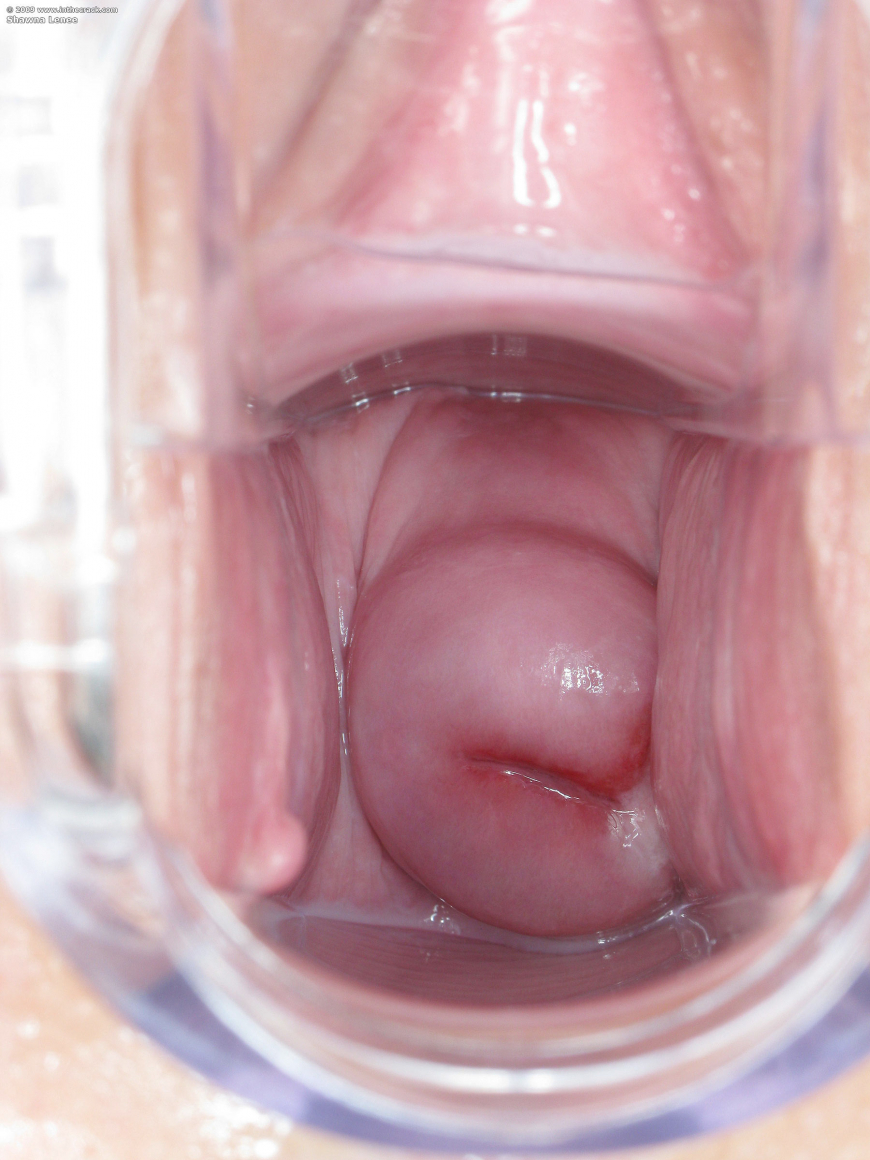 Внутренний вид влагалища