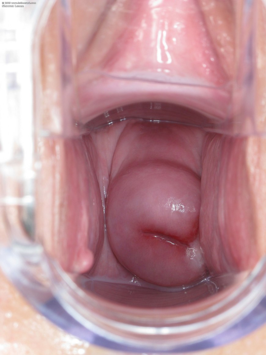 Внутренний вид влагалища