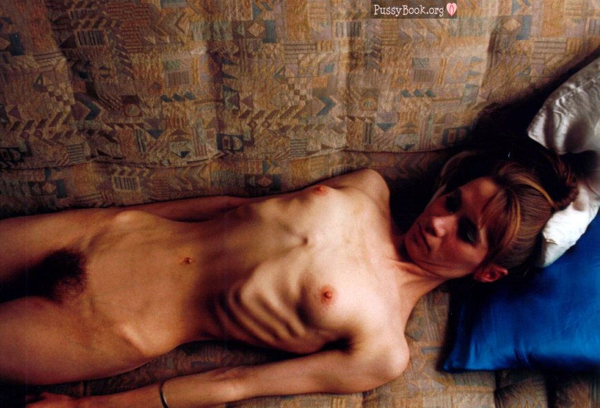 Девушки дистрофики лобки