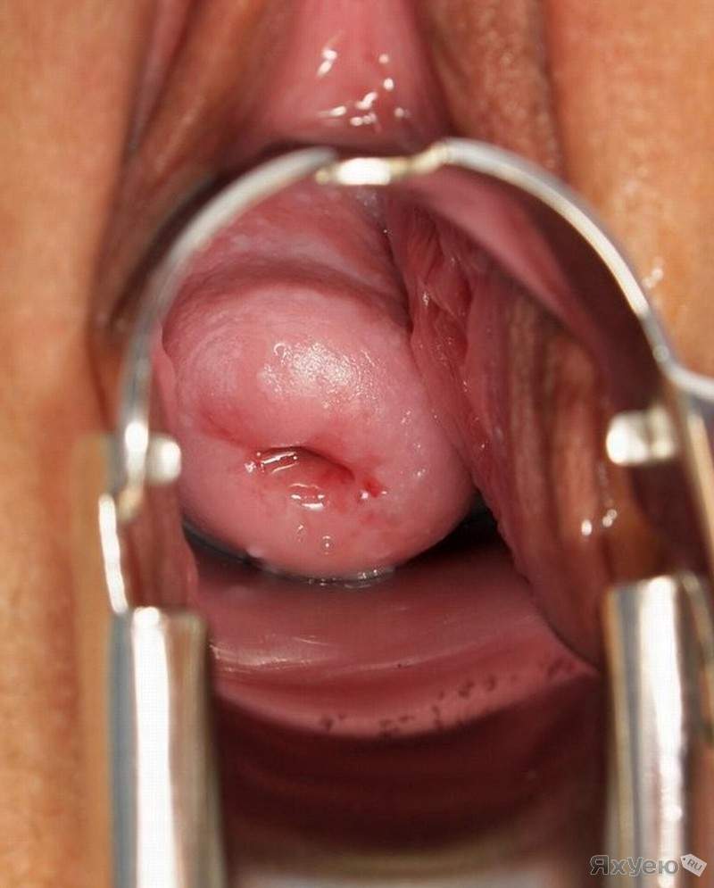 Камера во влагалище секс (83 фото)