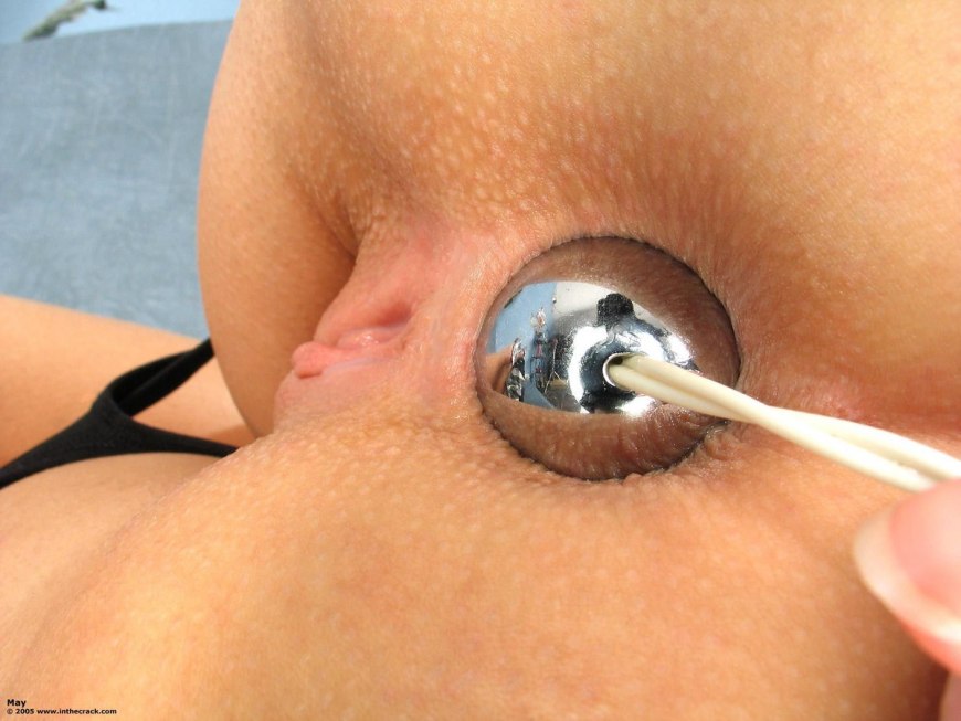 Анальная пробка застряла