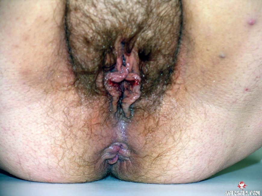 Влагалище толстых женщин