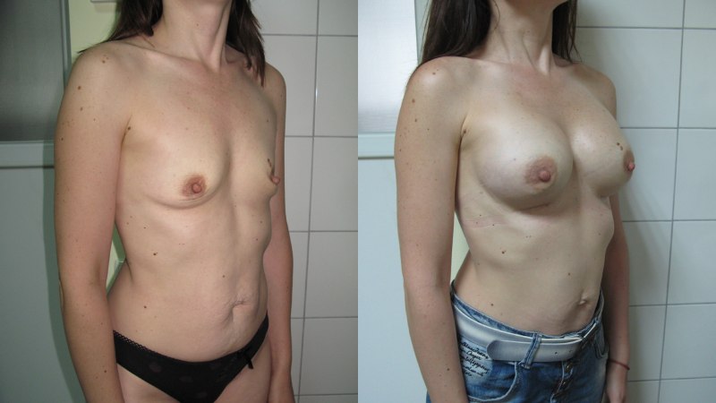 Сиськи первый размер голые