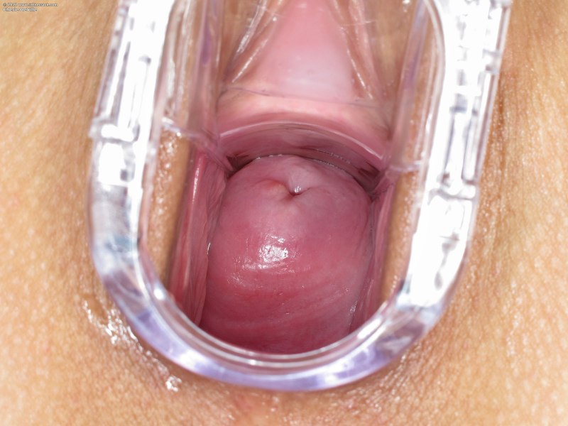 Женское влагалище внутри