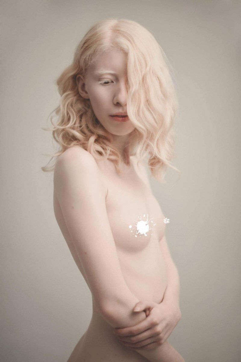 Грудь девушки альбиноса