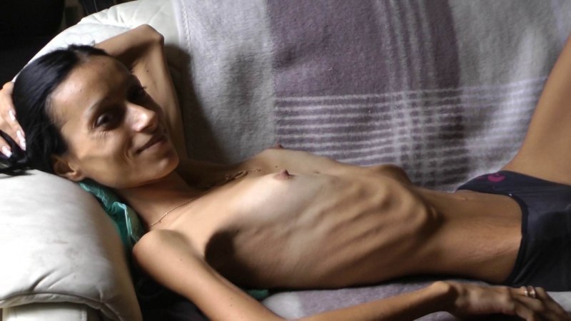 Эротичные девочки Анорексички