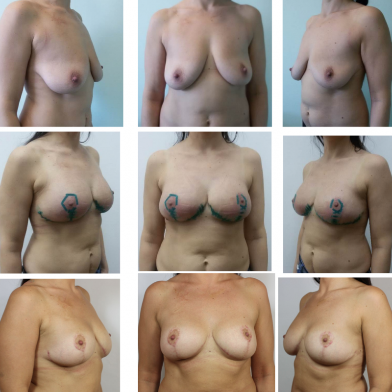 Разные формы женских Сисек