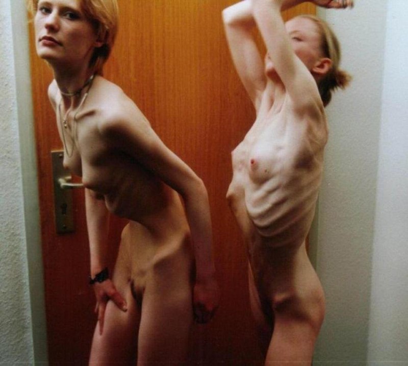 Голенькие Анорексички