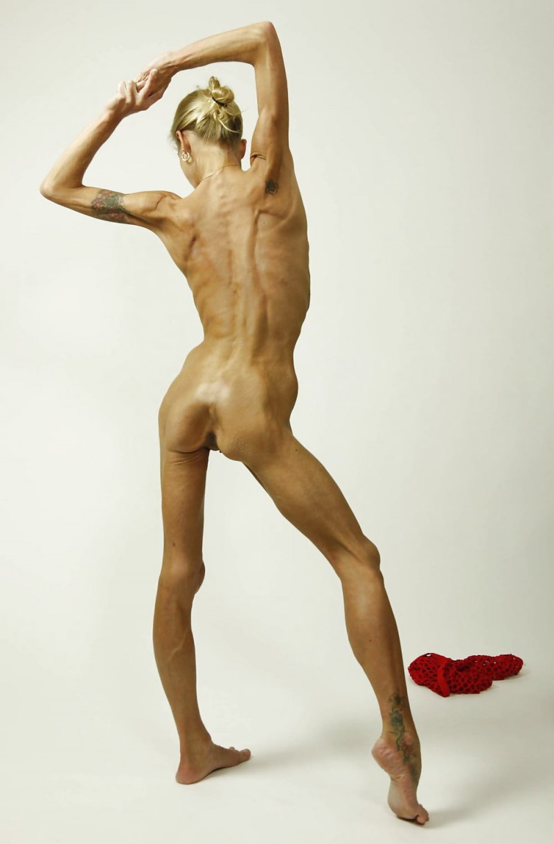 Голые женщины дистрофики