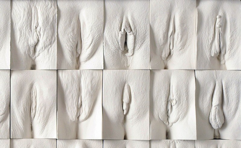 Необычное расположение вагины