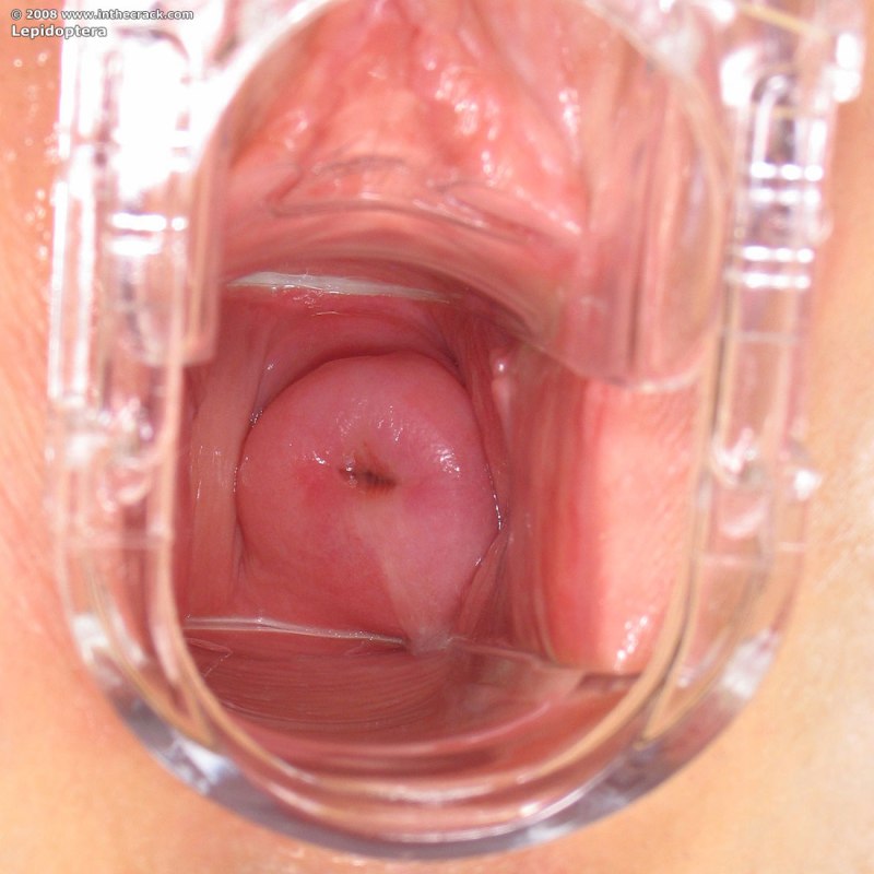 Женская вагина изнутри