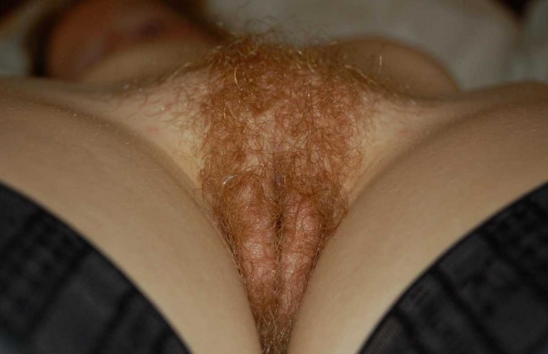 Рыжие волоски на лобке