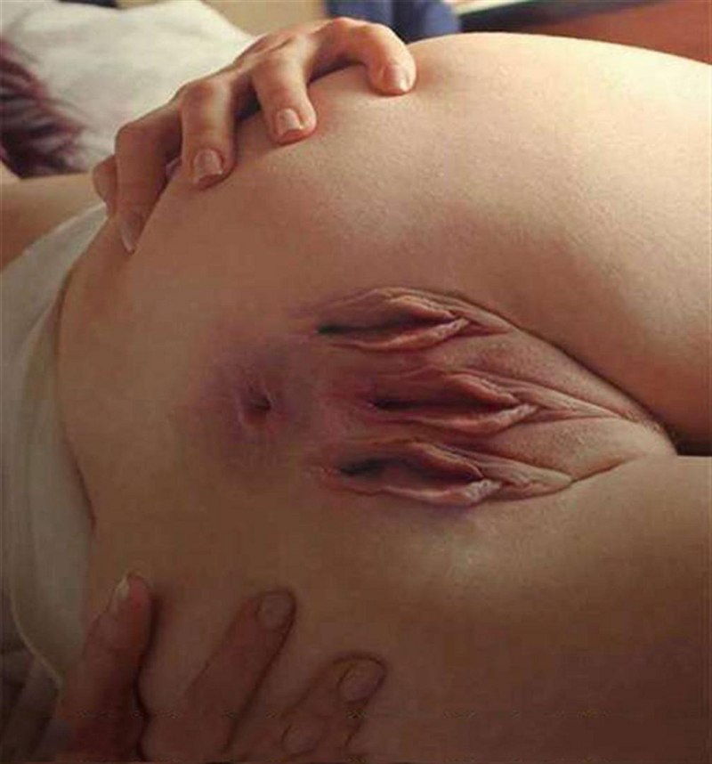 Необычное влагалище поперёк