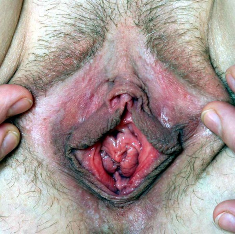 Самые страшные женские влагалища