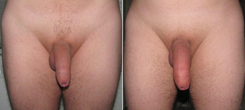 Виды полового члена