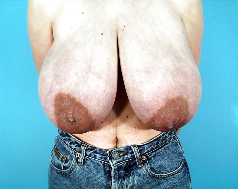 Некрасивые женские сиськи