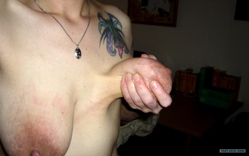 Самые уродливые сиськи