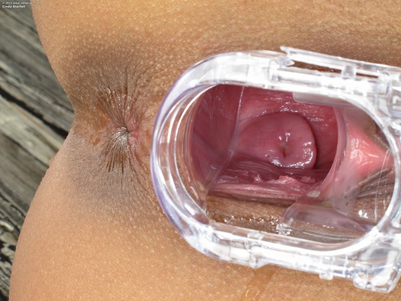 Влагалище и матка изнутри