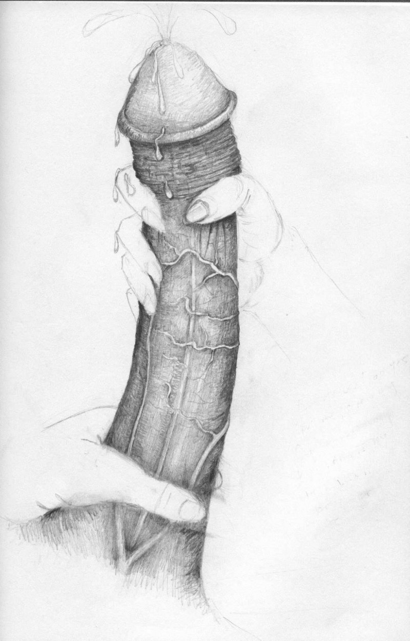 Рисунок анального траха