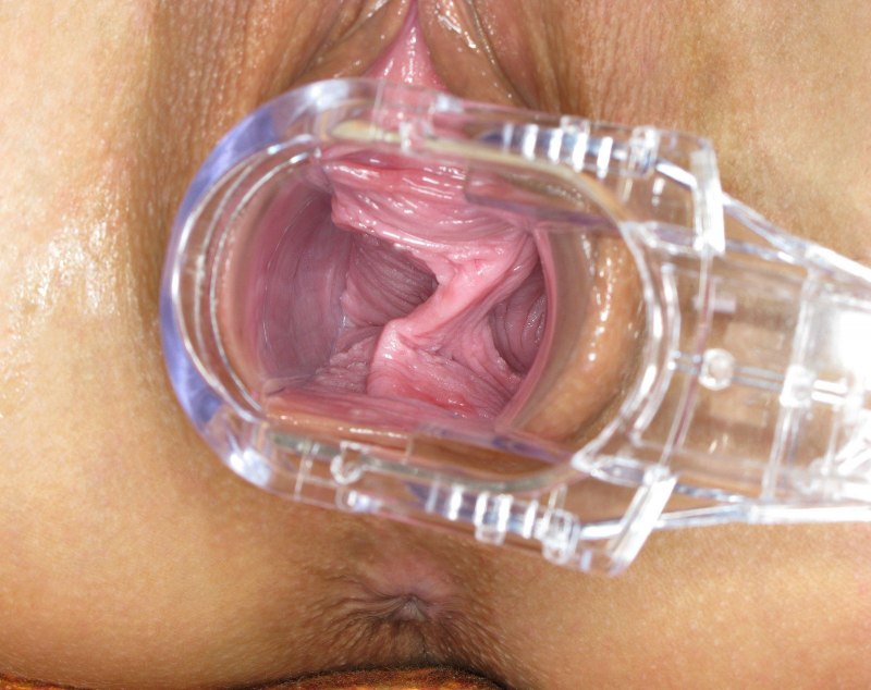 Здоровое влагалище внутри